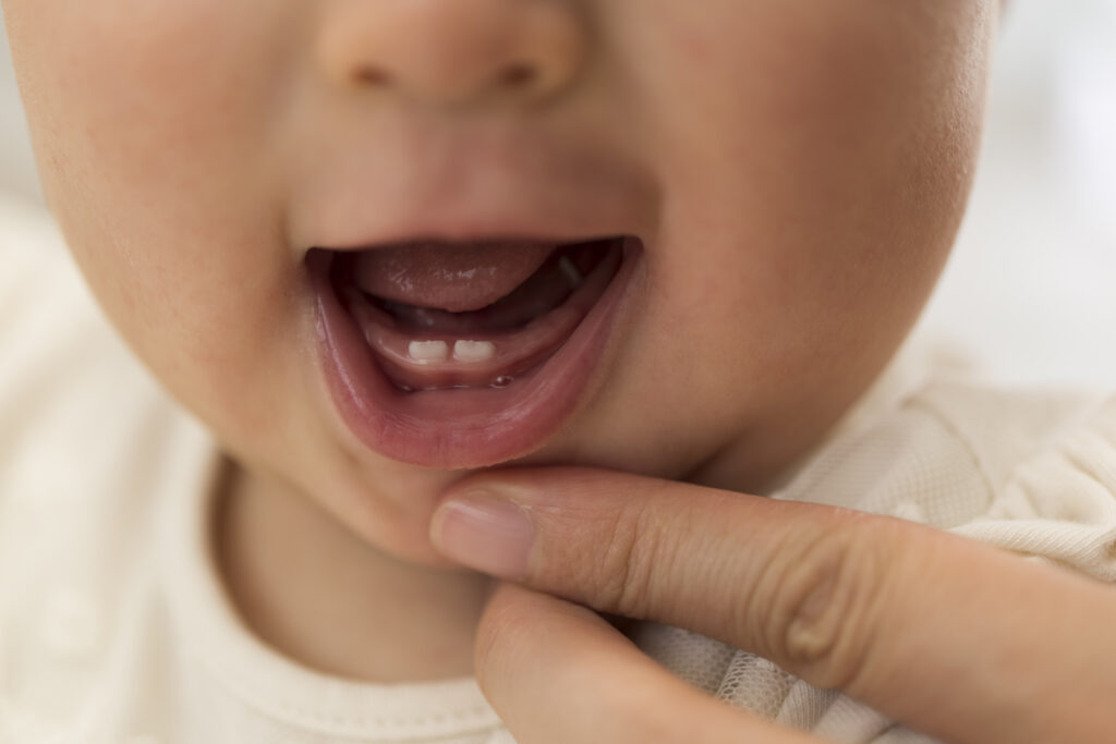Cómo cuidar los dientes de leche en la infancia
