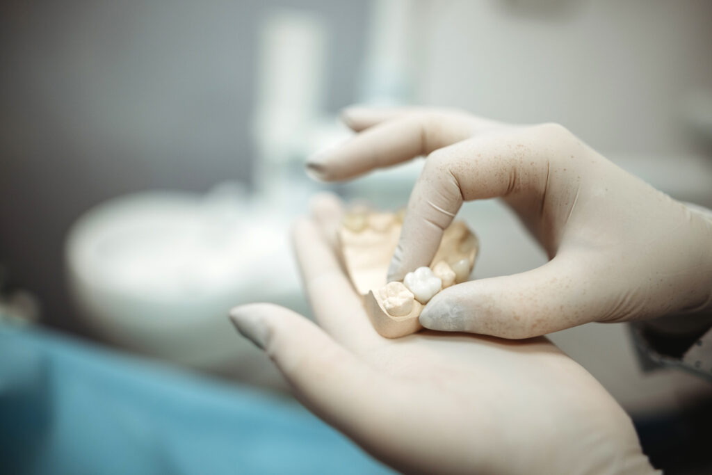Consejos para cuidar tus coronas dentales