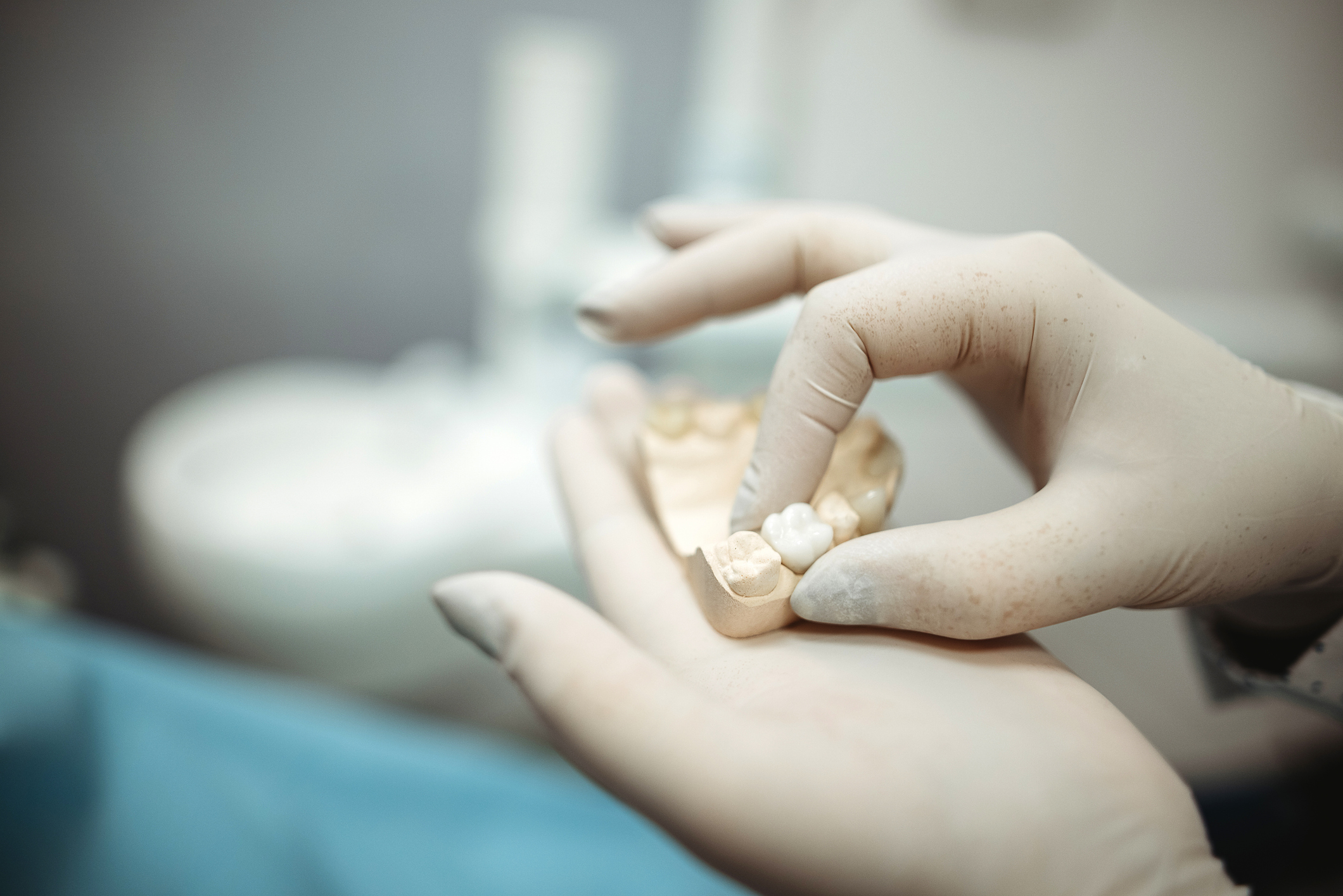 Consejos para cuidar tus coronas dentales
