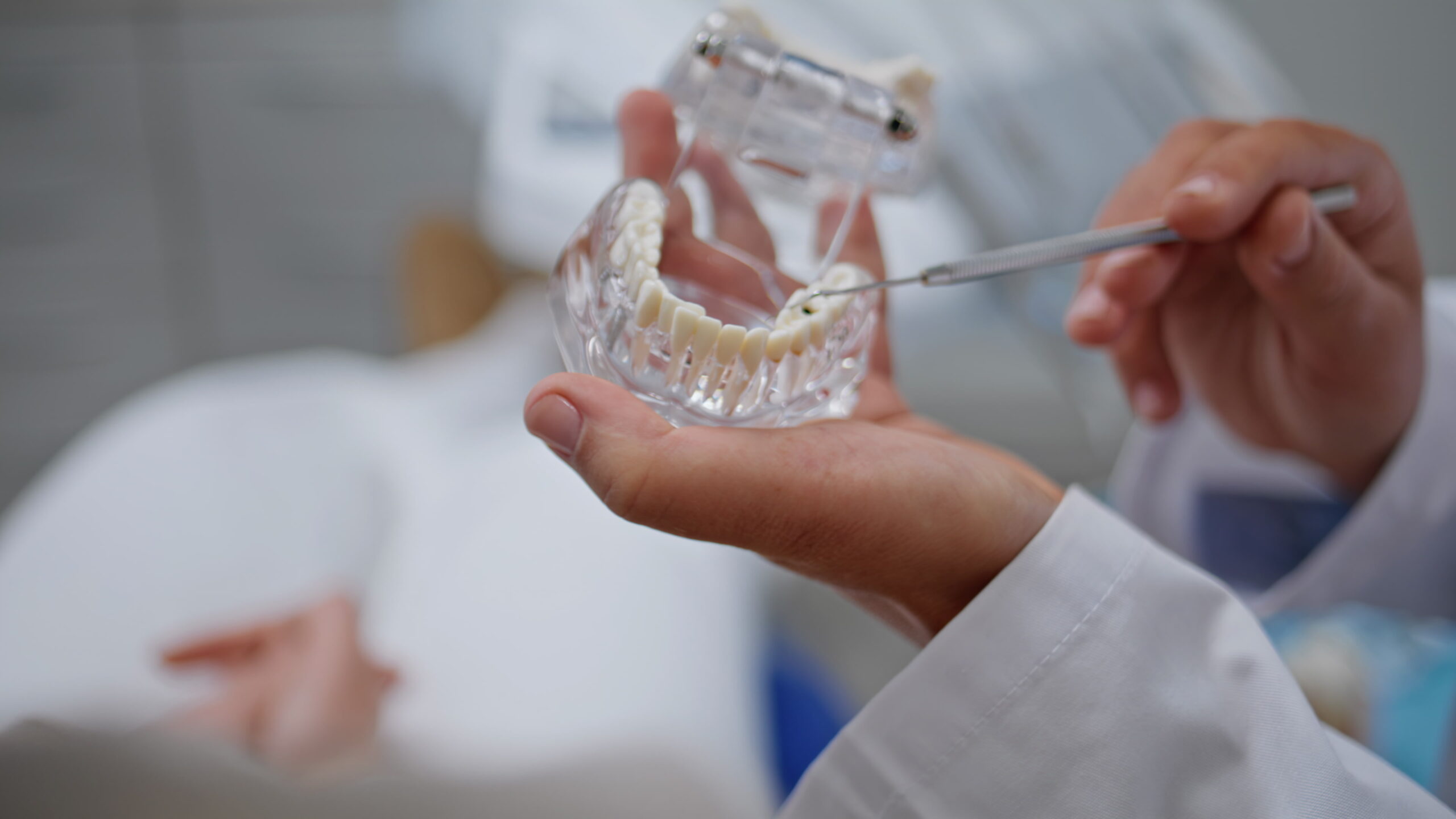 caries dentales