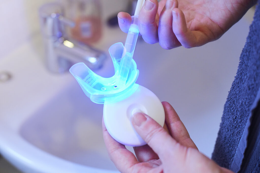 Riesgos del blanqueamiento dental con productos no homologados